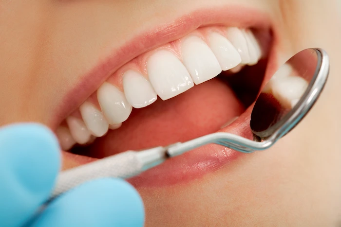 הלבנת שיניים באופן טבעי